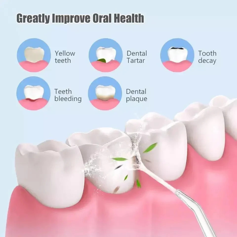 Irrigador Dental - Higiene Bucal de Nivel Profesional en Casa