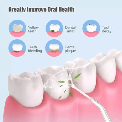 Irrigador Dental - Higiene Bucal de Nivel Profesional en Casa