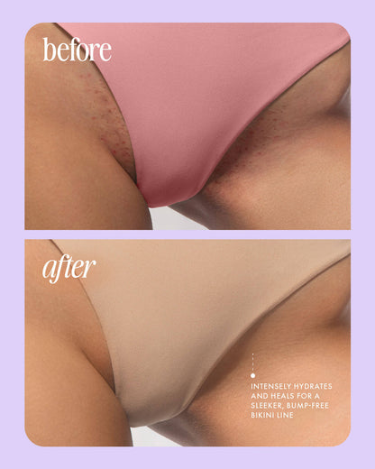 Truly Glazed – After Shave Glazed Donut, sin irritación ni vellos encarnados.