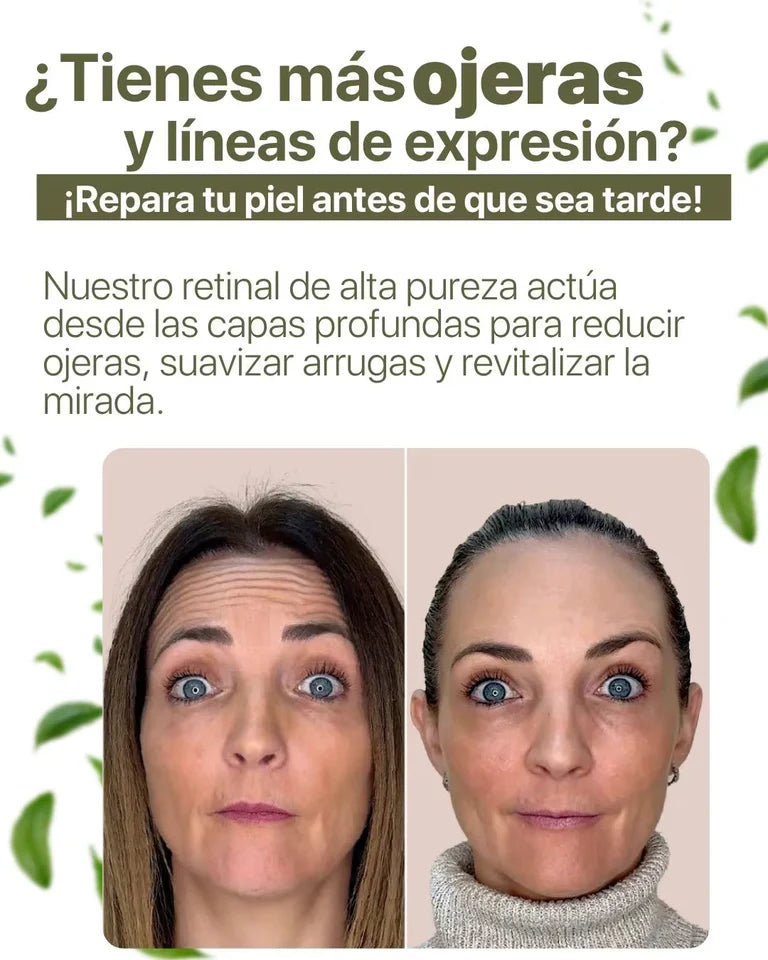 Reduce arrugas visibles, reafirma tu piel y recupera un rostro más joven desde las primeras semanas