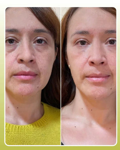 Reduce arrugas visibles, reafirma tu piel y recupera un rostro más joven desde las primeras semanas